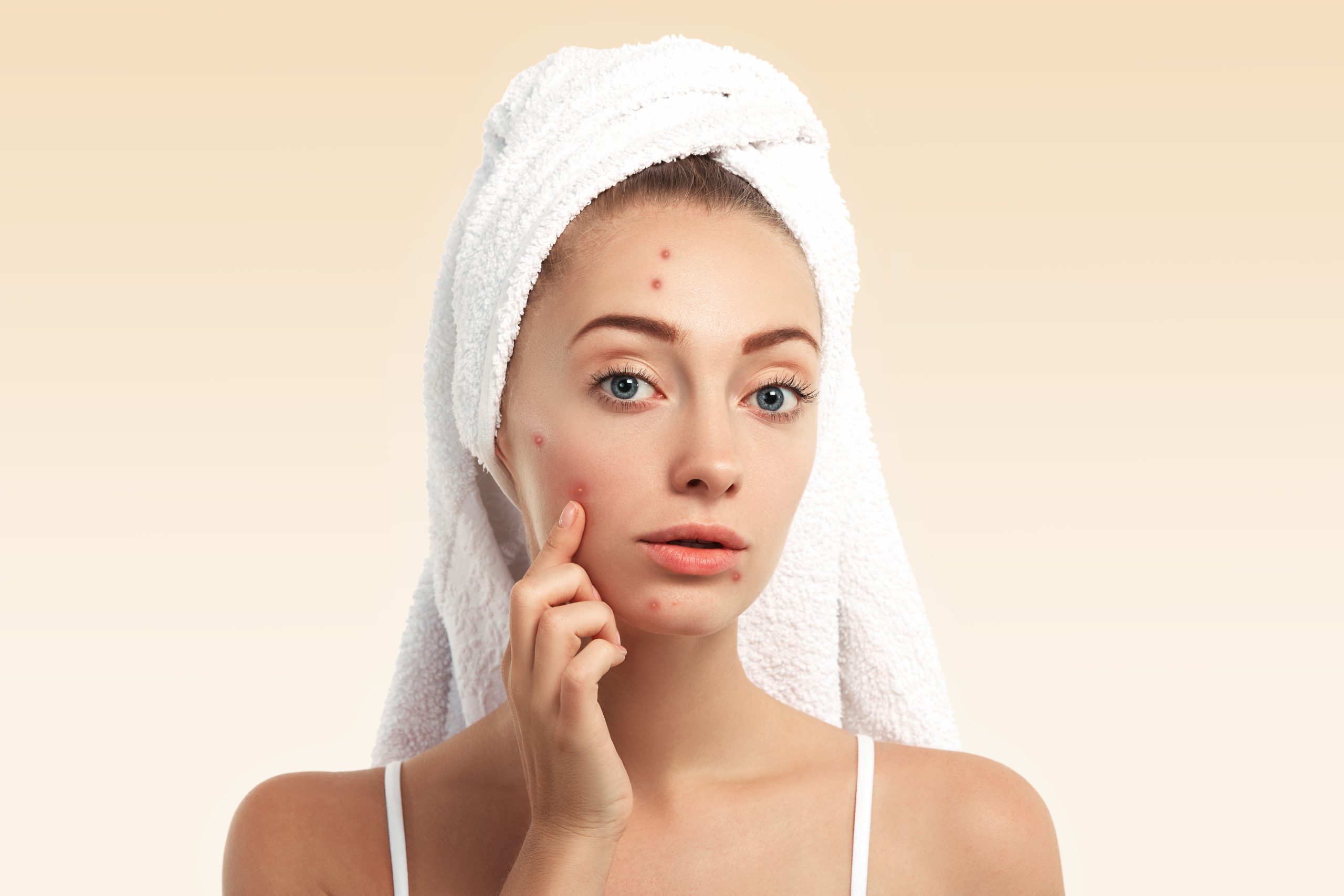 Treatment Pimple Treatment