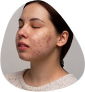Dark Spots And Pigmentation