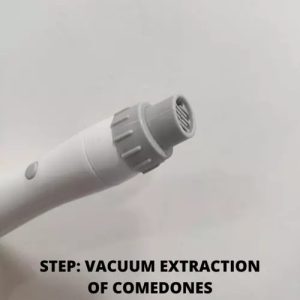 Vacuum extraction of comedones