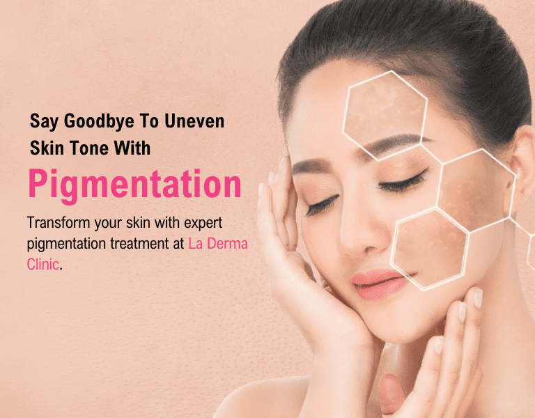 Dark Spot Treatment