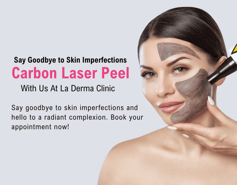 Carbon Laser Facial in Kolkata