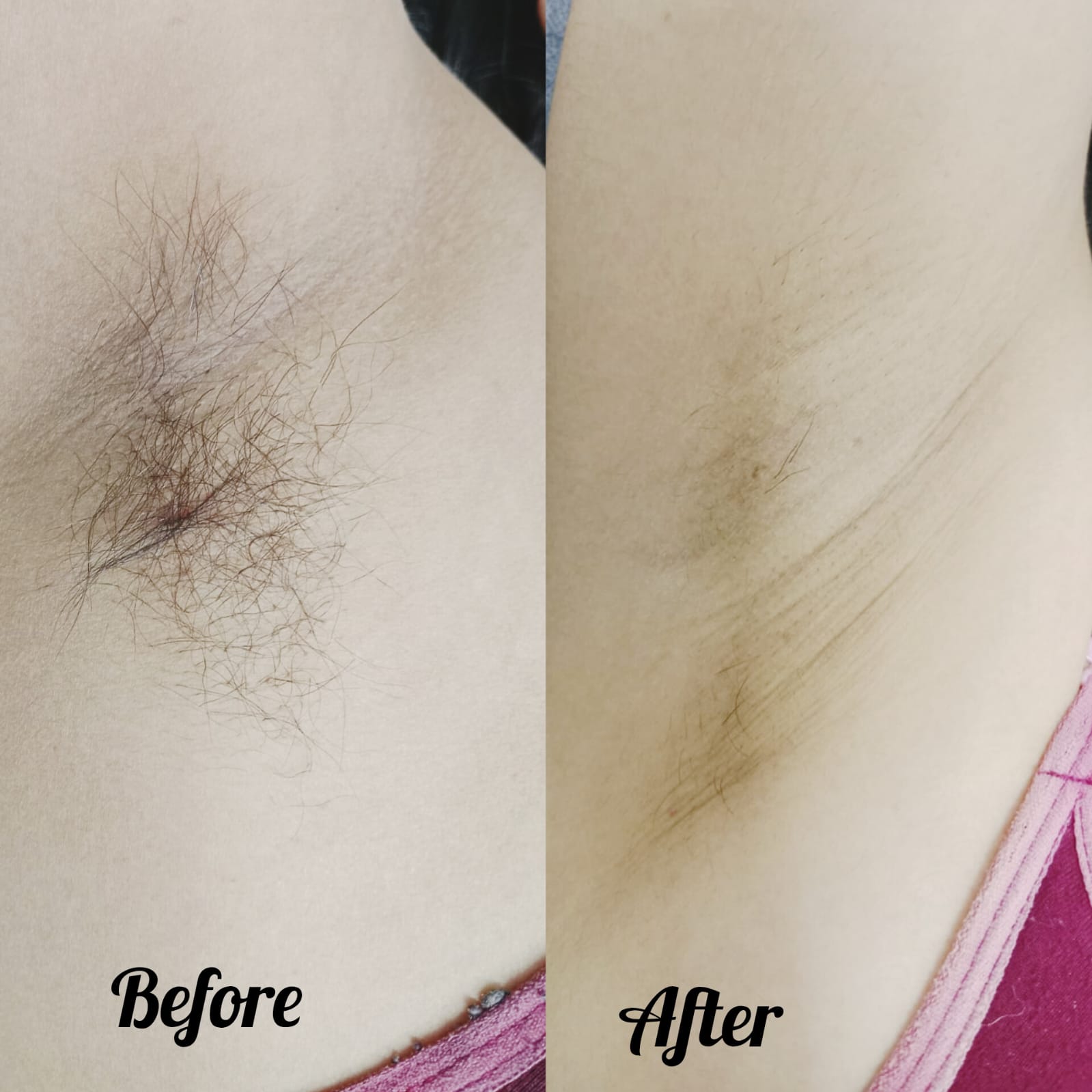 after before
