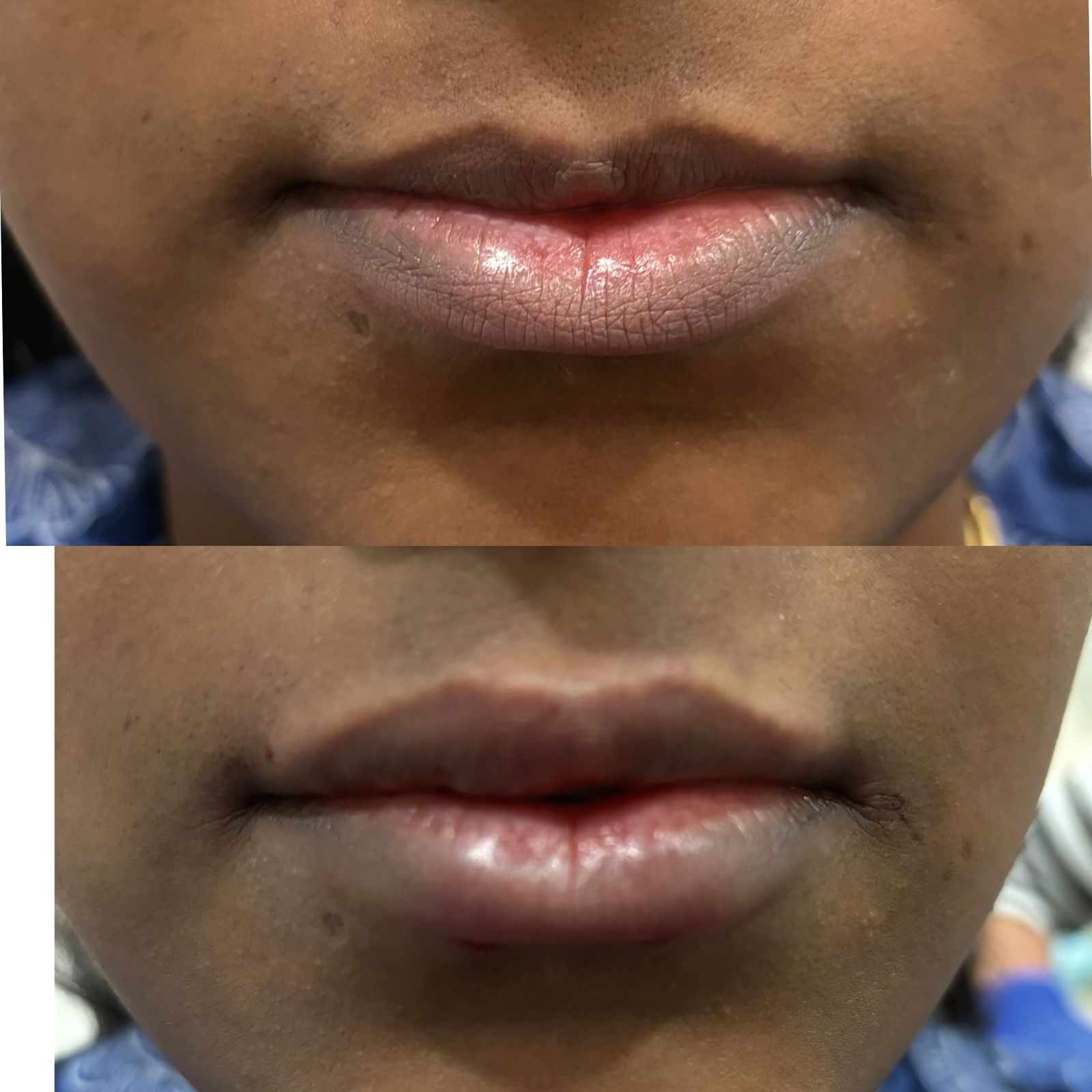 after before