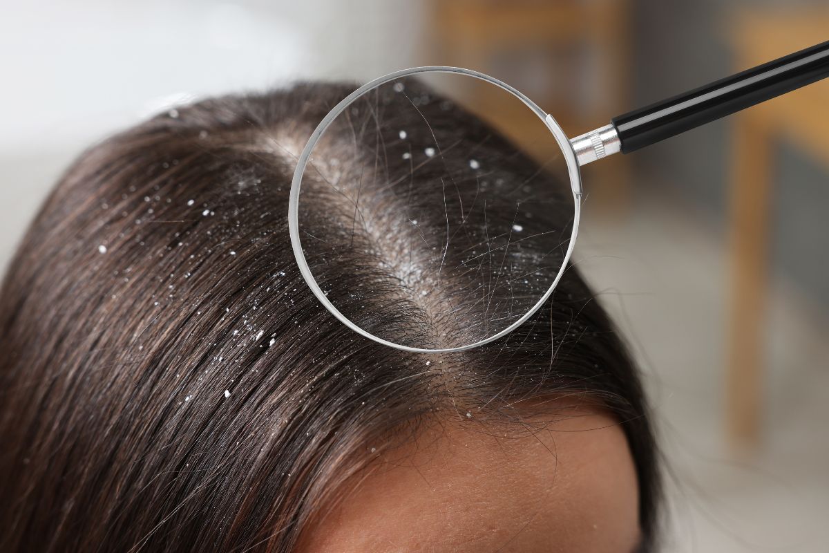 https://drkhushbutantia.com/wp-content/uploads/2025/10/Scalp-Problems.jpg