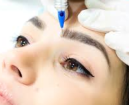 https://drkhushbutantia.com/wp-content/uploads/2026/04/Classic-Microblading.webp