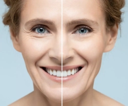 https://drkhushbutantia.com/wp-content/uploads/2026/05/Cheek-Tightening-Treatment.webp