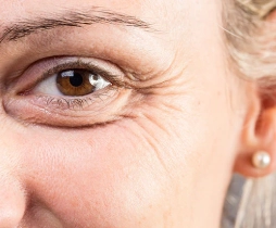 https://drkhushbutantia.com/wp-content/uploads/2026/05/Lines-near-the-eye.webp