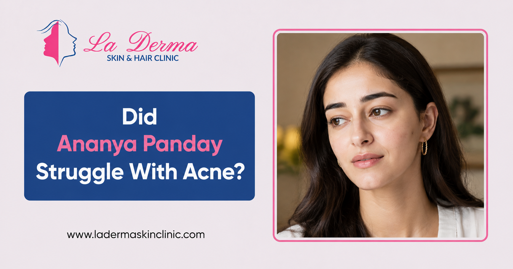 Did Ananya Panday Struggle With Acne?