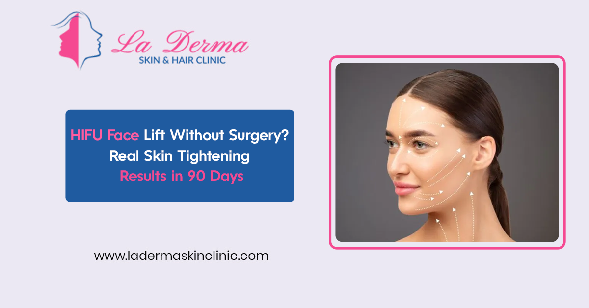 HIFU Face Lift Without Surgery? Real Skin Tightening Results in 90 Days