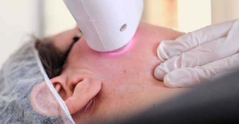 https://drkhushbutantia.com/wp-content/uploads/2026/07/Laser-Toning.jpg