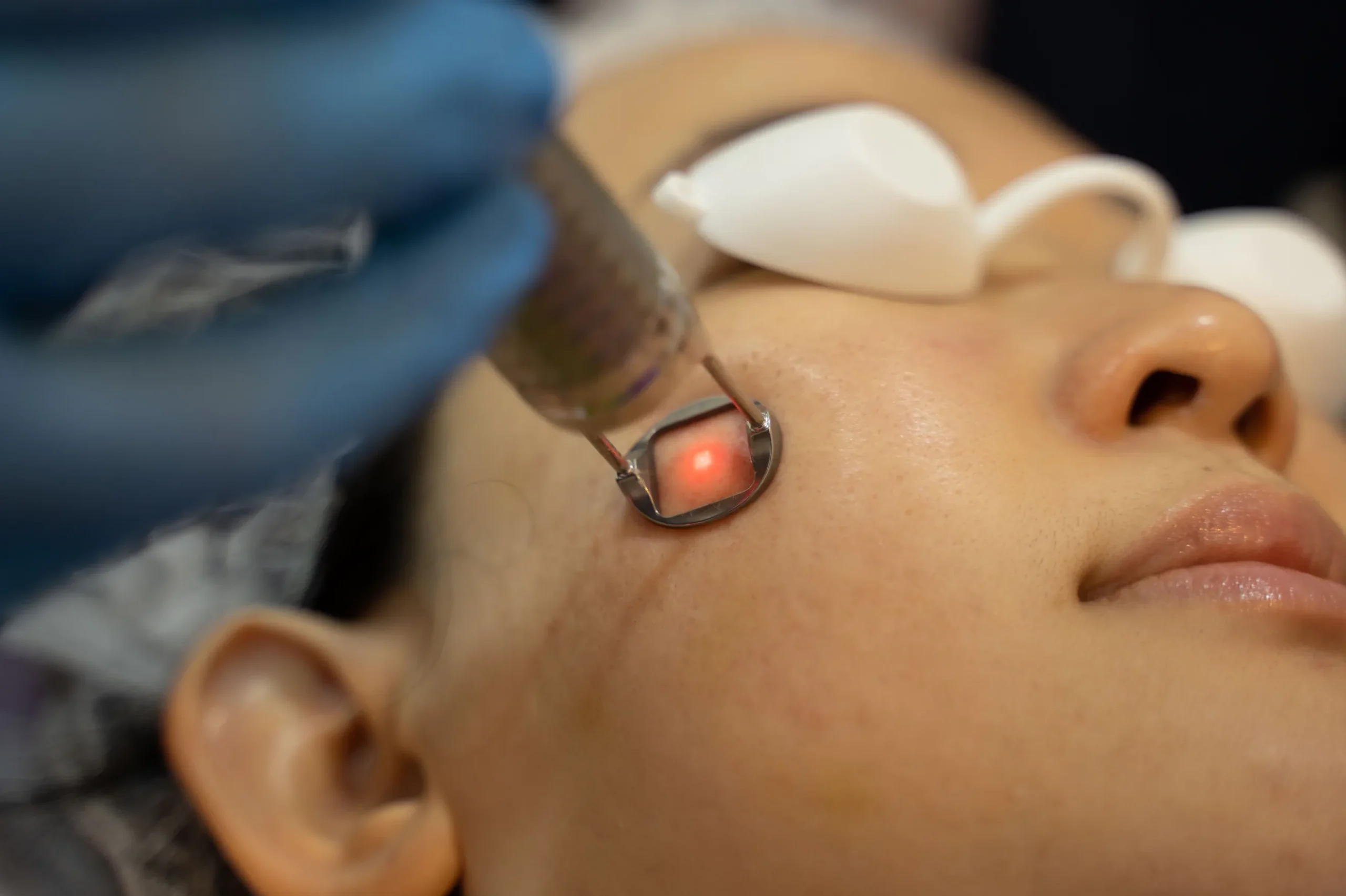 https://drkhushbutantia.com/wp-content/uploads/2026/07/Pico-Laser-scaled.webp
